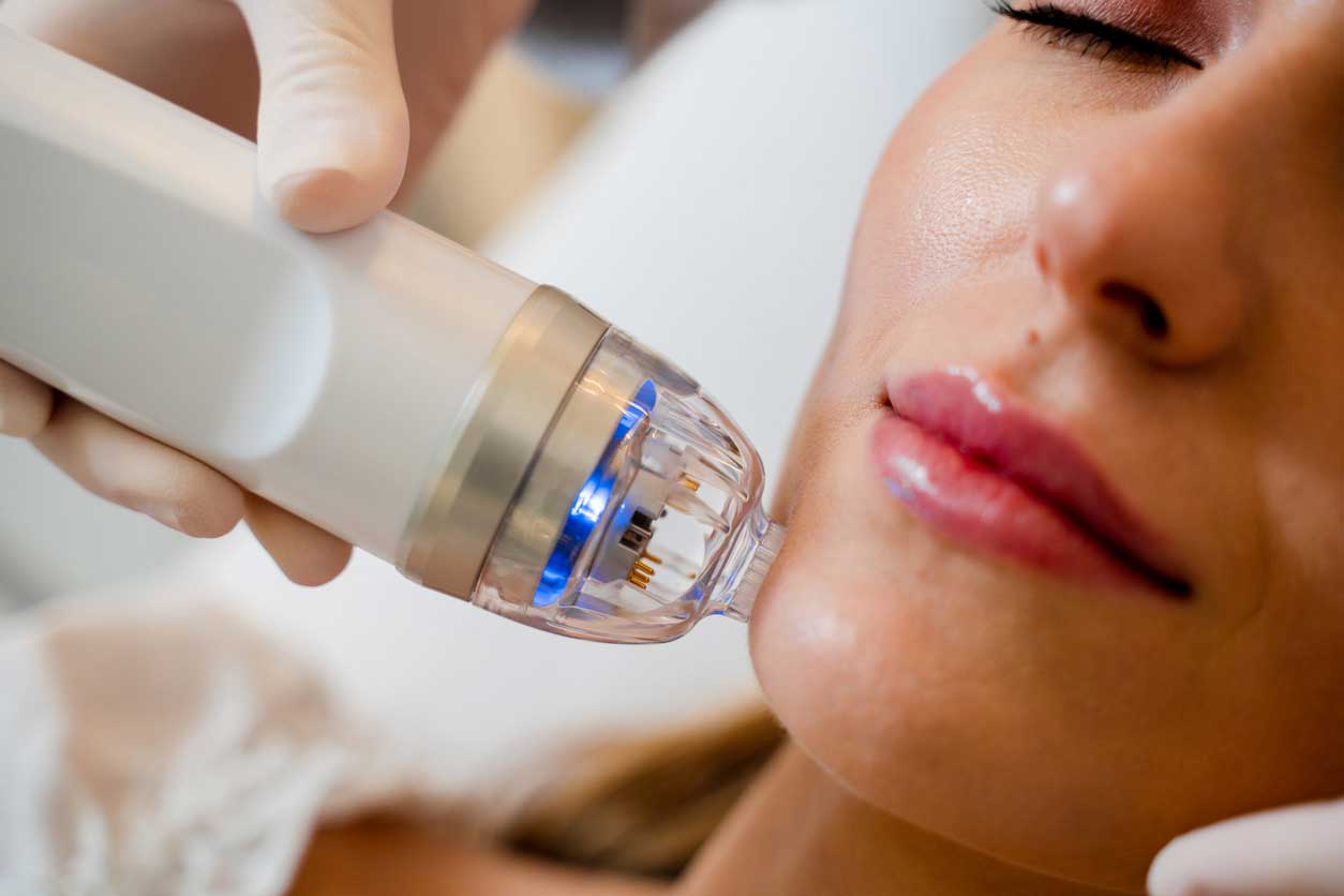 patient getting microneedling treatment